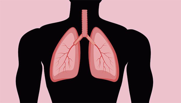 Lungesygdom